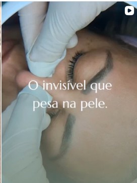 Tratamento facial detalhado